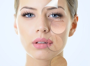 Lão hóa da sớm ở phụ nữ, nguyên nhân do đâu?